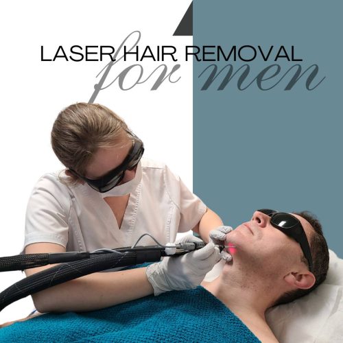 Laser hair removal for men